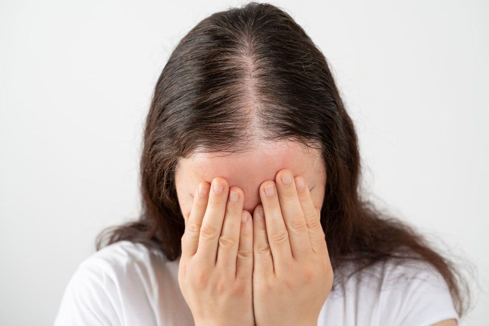 Hair Loss in Women – HealthyWomen