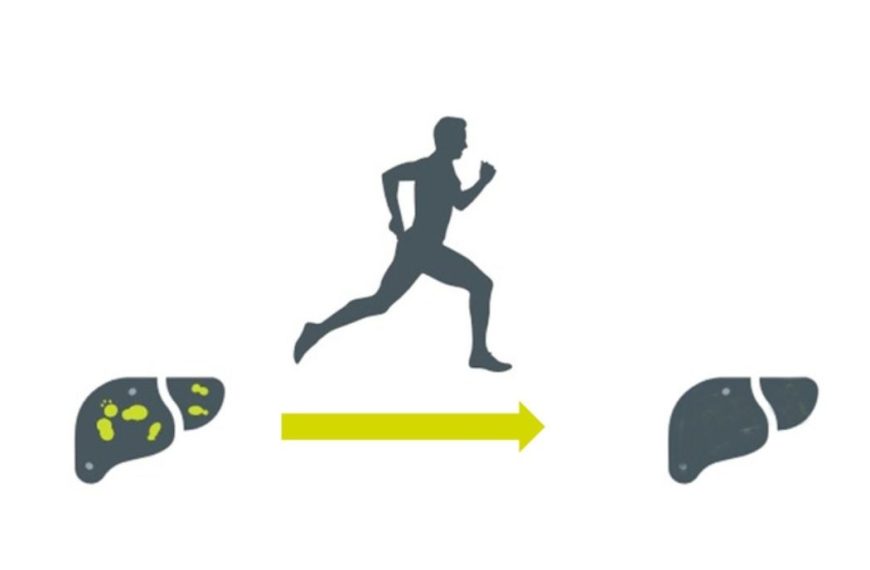 NAFLD and Physical Exercise: Take Charge!